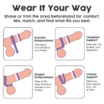 Educational infographic showing four penile implant configurations to customize comfort and support: Erection Enhancement, Targeted Support, Staged Enhancement, and Venous Support.